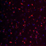Immunofluorescent image of a human brain labeled with DSHB antibody Anti-CHAT [BCN561.2.1F4] against Choline O-acetyltransferase (red). Image Credit: BICCN.
